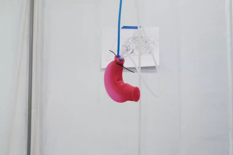 Amos Peled, Operation Theatre at Tetem